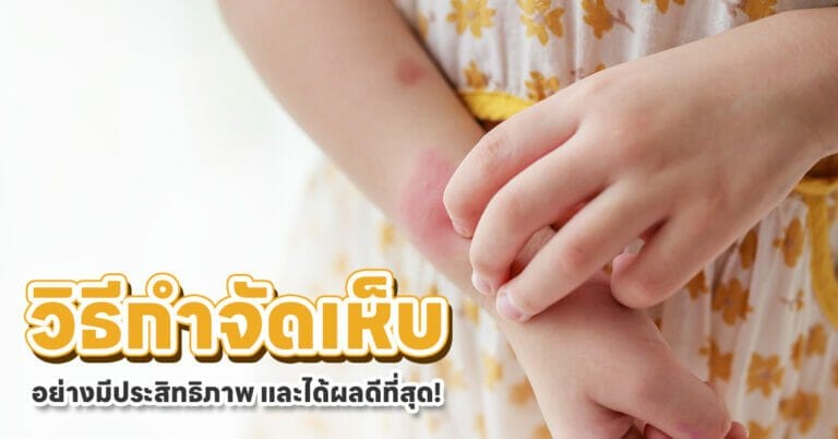 วิธีกำจัดเห็บ